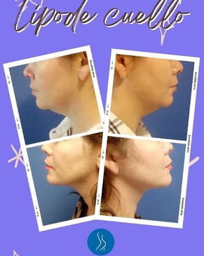 Slider image (3) Dr. Adan Perez Lopez 